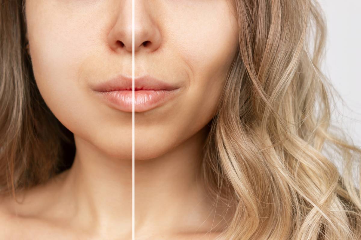 Low Cheekbones vs. High Cheekbones: How to Locate and Modify