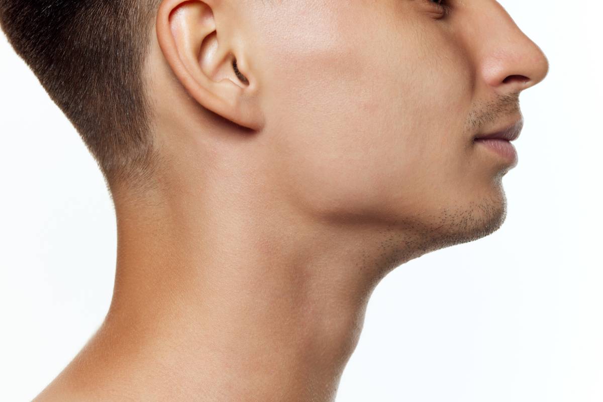 Featured image for How Long Do Chin Implants Last?